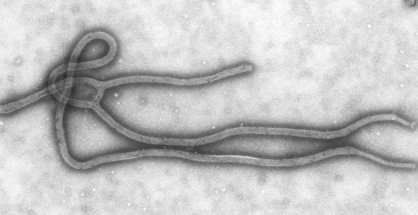 Virus Ebola filovirus