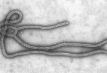 Virus Ebola filovirus