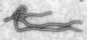 Virus Ebola filovirus