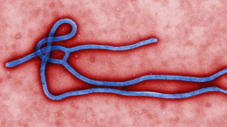 Ebola, une volontaire française de Médecins Sans Frontières touchée par le virus