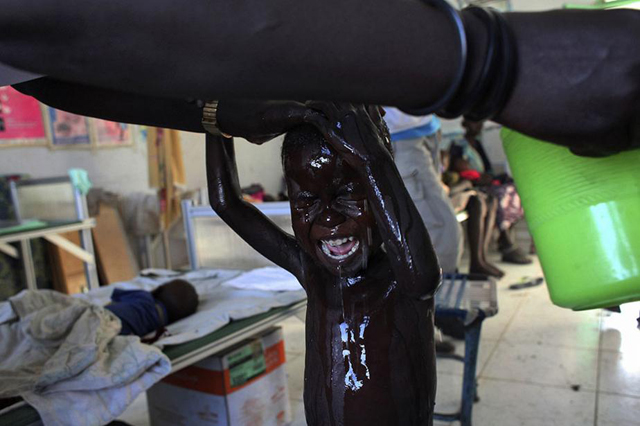 Un enfant sud-soudanais déplacé par les combats à Malakal pleure alors qu’une infirmière le lave dans un centre de nutrition géré par Médecins sans frontières (MSF) à Kodok. Il souffre d’une grave malnutrition. 