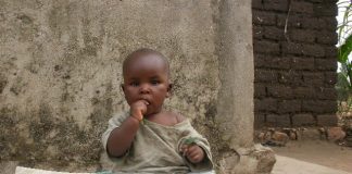 Un enfant victime de malnutrition au Burundi