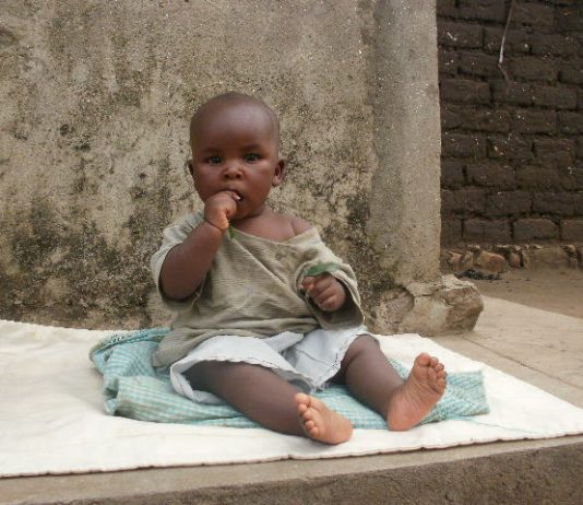 La malnutrition, principale cause des décès des enfants de moins de cinq ans au Burundi Un enfant victime de malnutrition au Burundi
