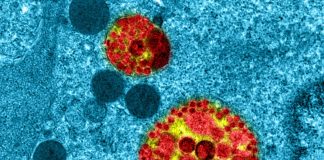 Cellules coronavirus