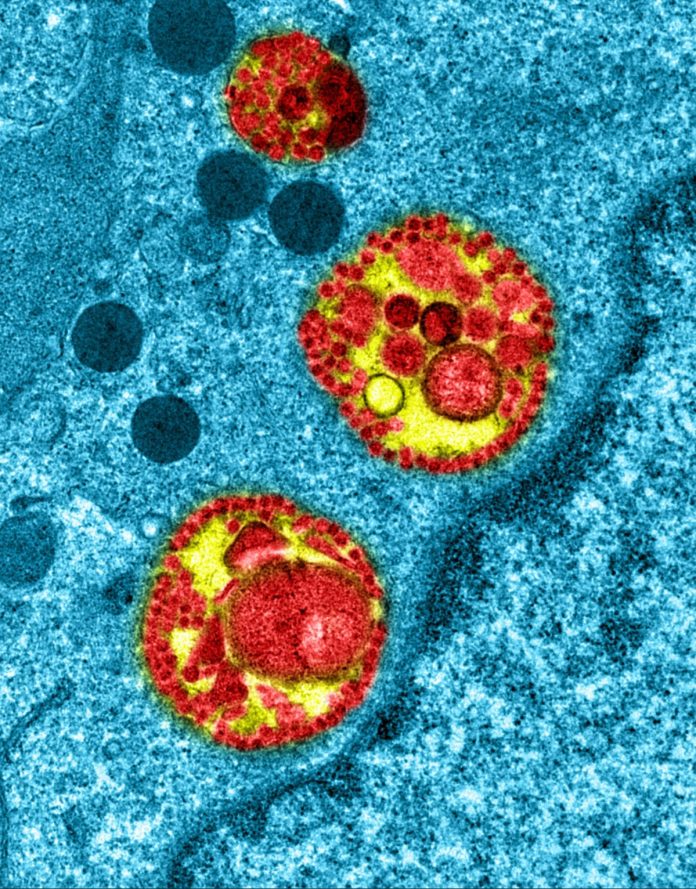 Cellules coronavirus